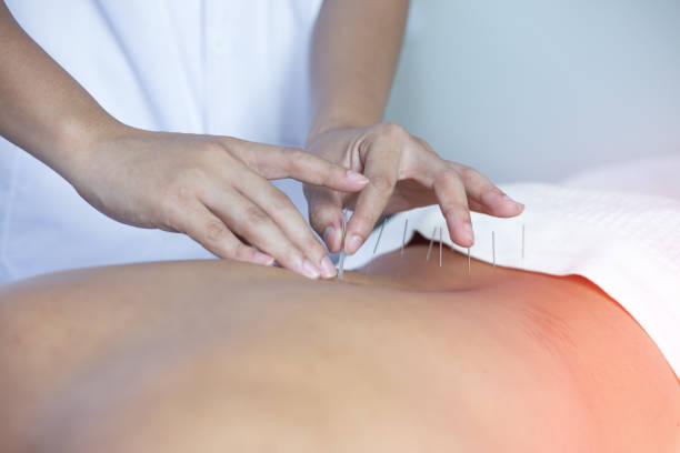 Traditional Chinese Medicine Treatment - Acupuncture